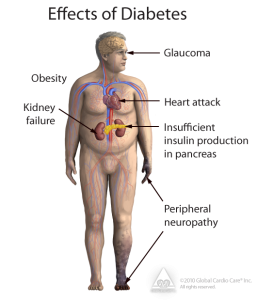 diabetes-1