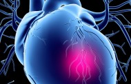 Factors that predispose to coronary heart disease