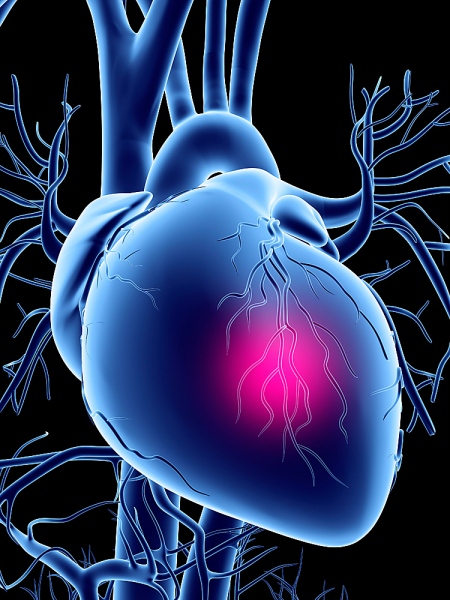 Factors that predispose to coronary heart disease